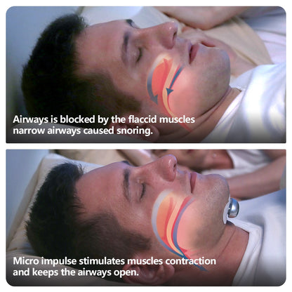 SleepQuiet Pro™ — Stop Snoring Tonight